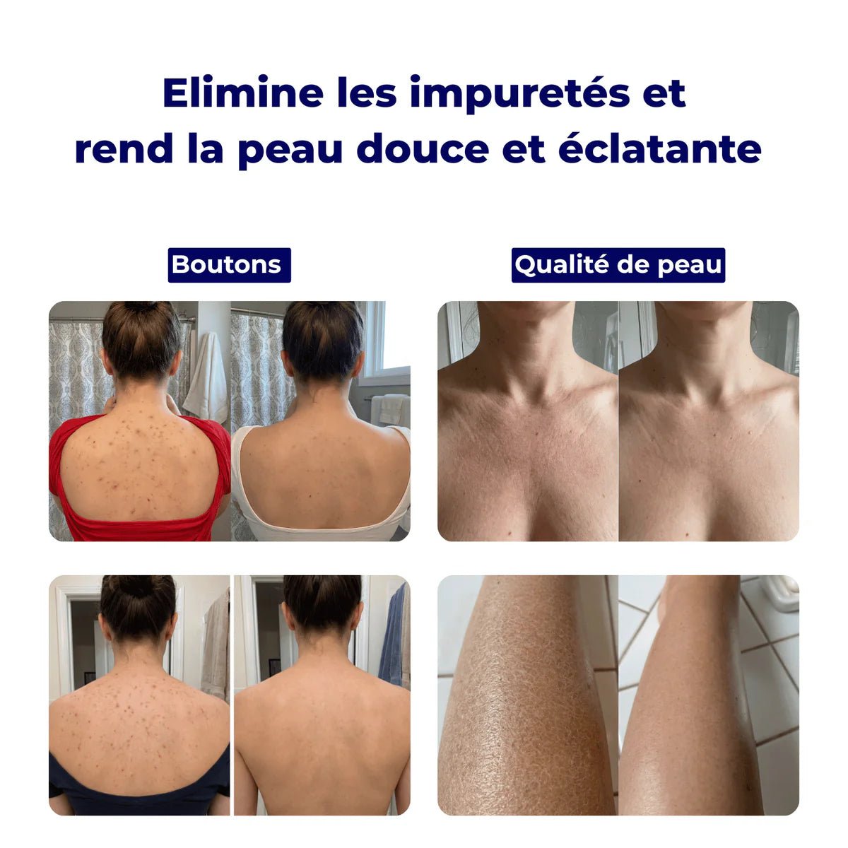 Serviette Exfoliante Antibactérienne pour Douche - Isamundo