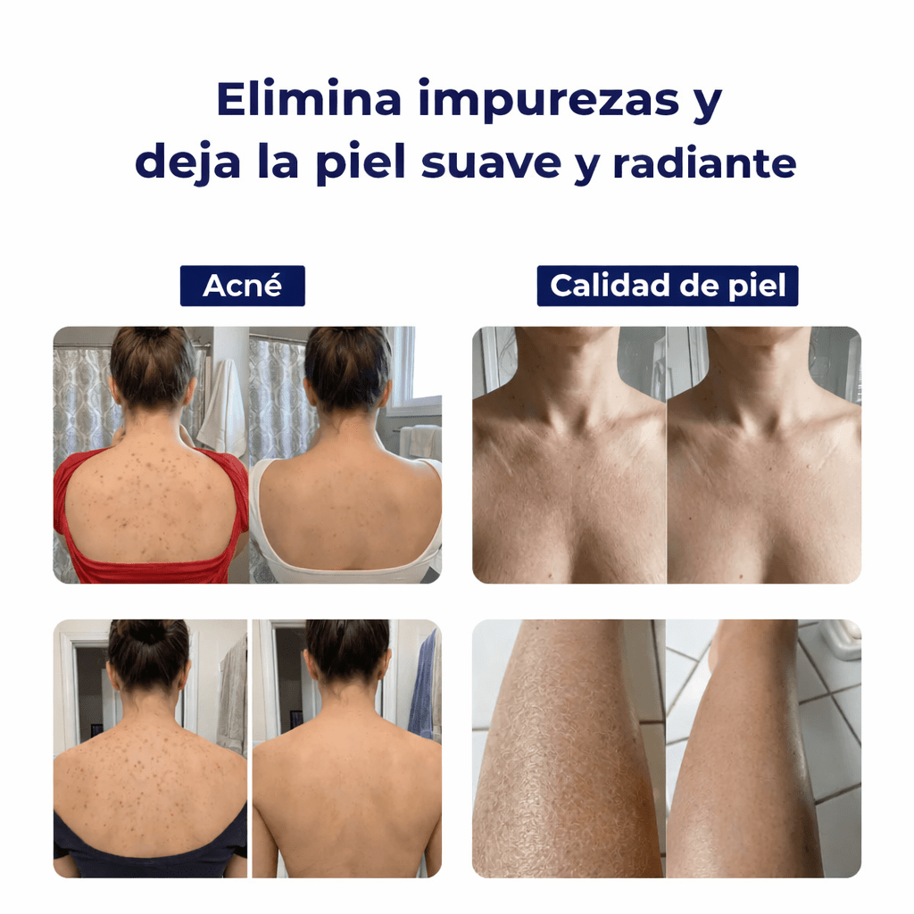 Toalla Exfoliante Antibacteriana para Ducha - Isamundo